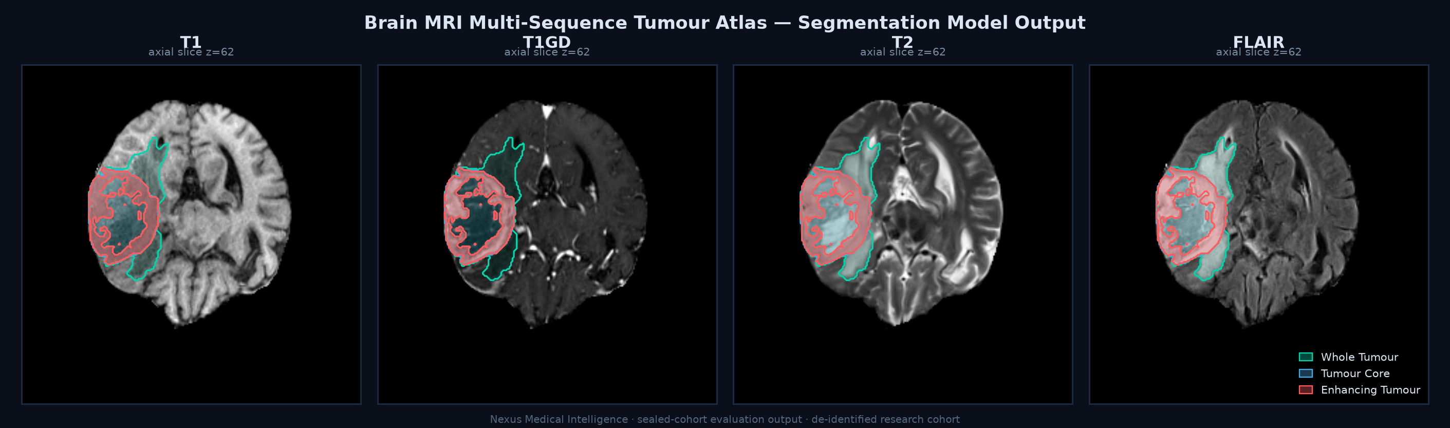 Multi-sequence tumour atlas