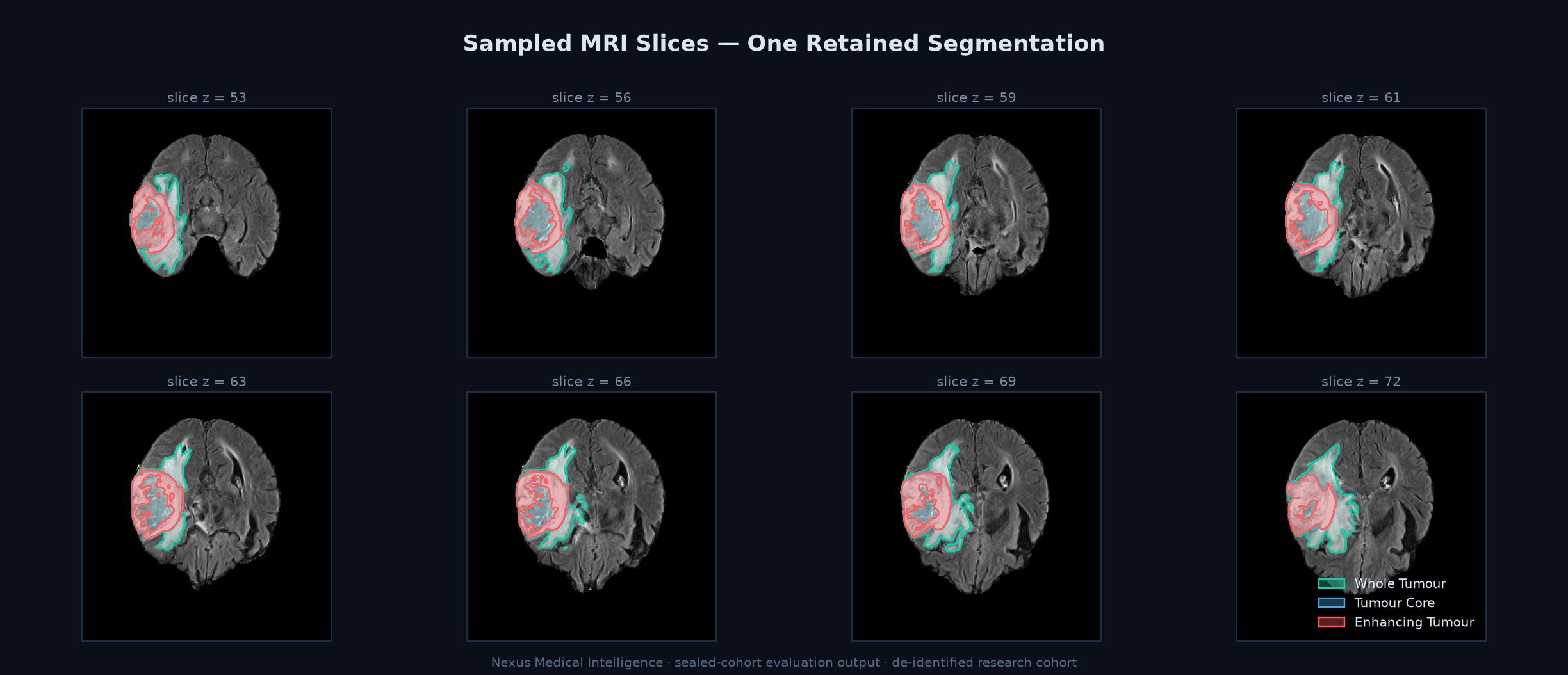 A retained prediction across sampled slices