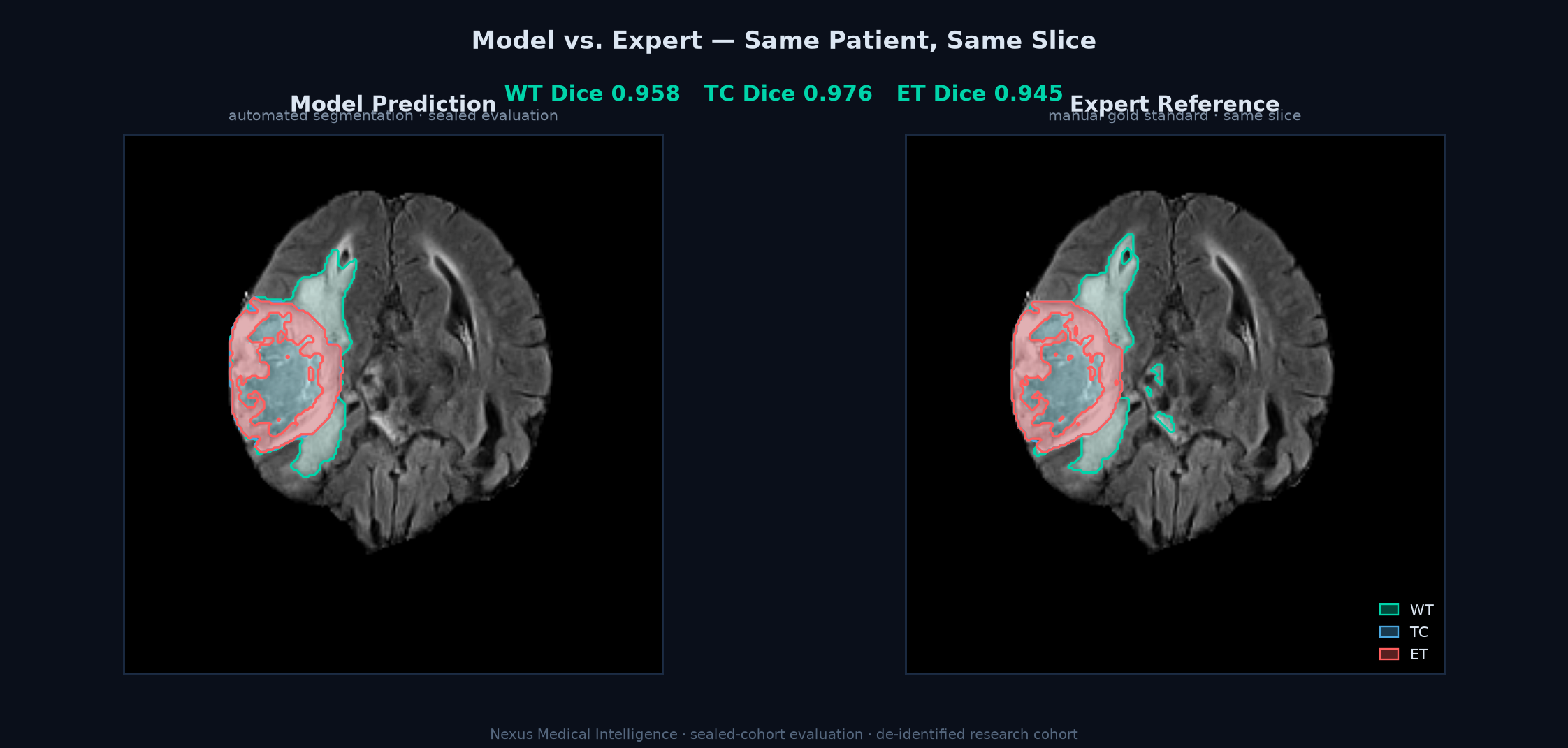 Model prediction beside the expert reference