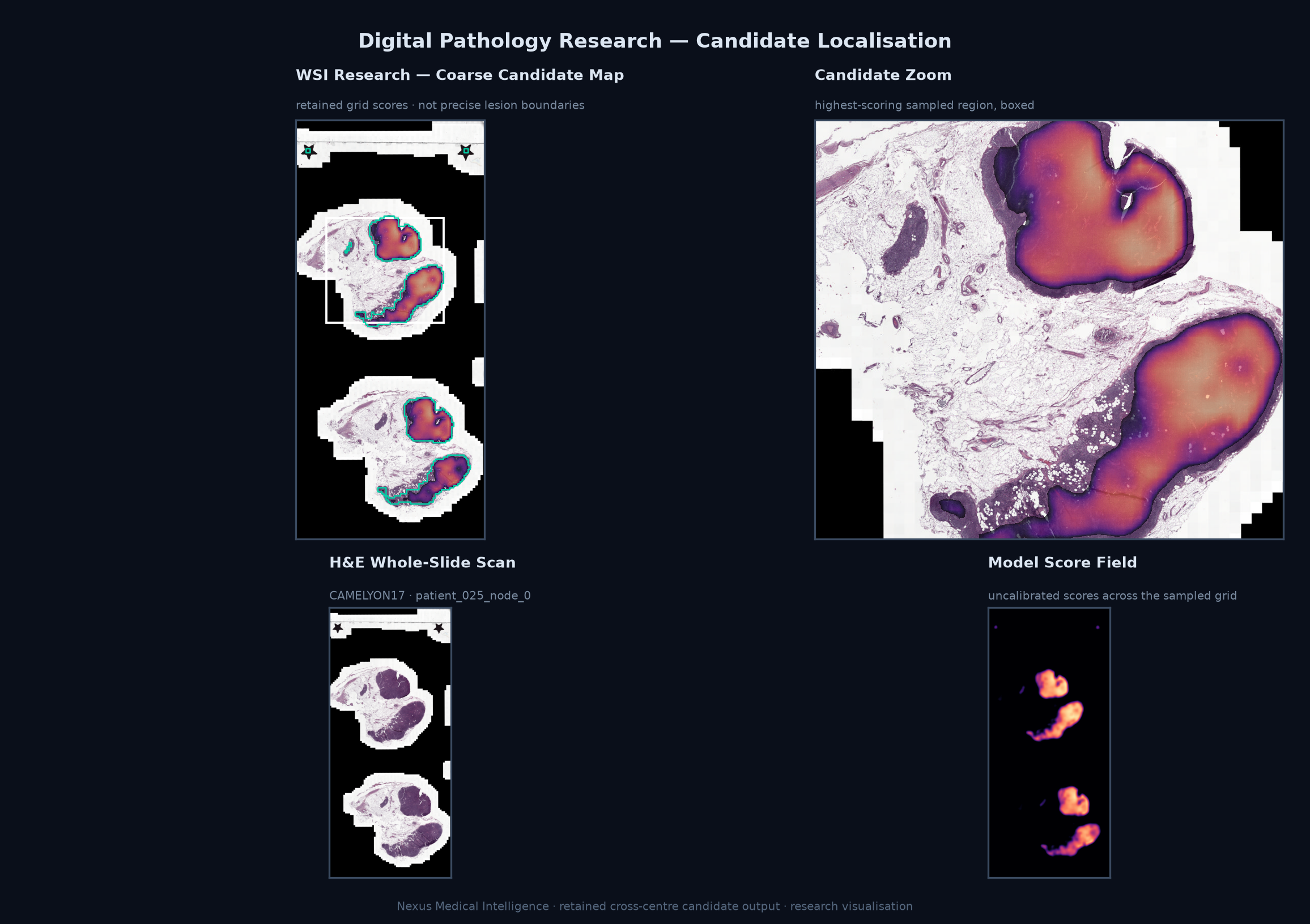 Whole-slide candidate localisation research